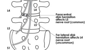 Lumbar Region | Southern Ontario College of Osteopathy